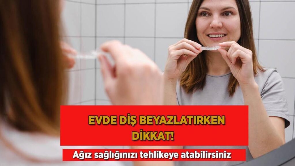 Konutta diş beyazlatırken dikkat! Ağız sıhhatinizi tehlikeye atabilirsiniz