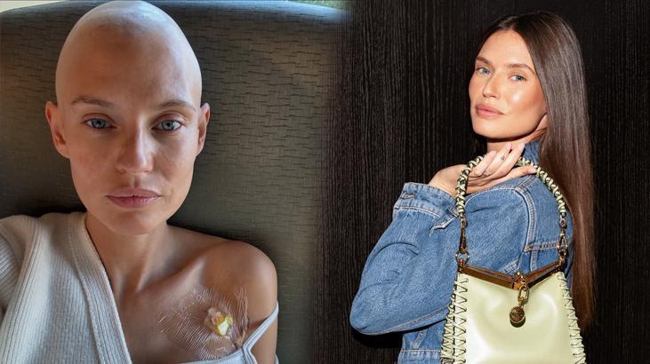 Kansere yakalandığını duyurmuştu! Victoria’s Secret meleği Bianca Balti’nin son hali ortaya çıktı