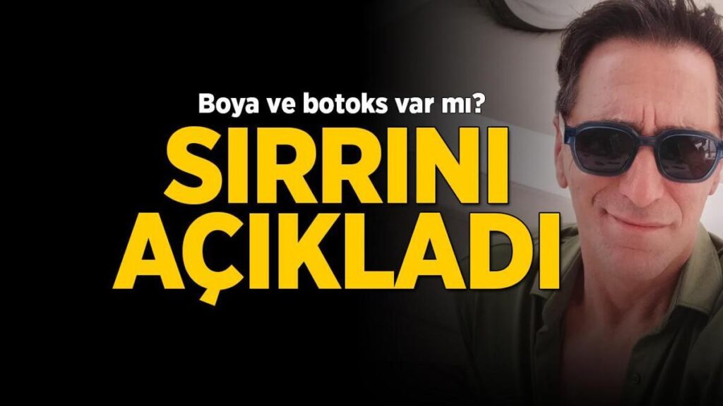 İmajı hiç değişmedi Bekir Aksoy sırrını açıkladı! Botoks yaptırdı mı?
